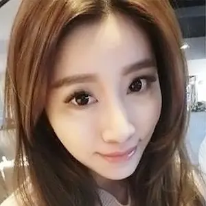 醫美案例|縮人中手術+鈴鐺線拉提+玻尿酸臥蠶