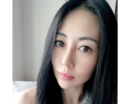 手術案例|蒜頭鼻的剋星，自體軟骨鼻頭整型