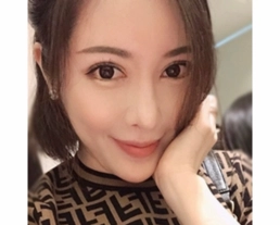 手術案例|美女的“關鍵第八次重修手術“分離疤痕組織神任務!!