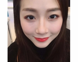 手術案例|美的宛如天生般自然，關鍵在醫師的美感和手感