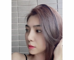 手術案例|還在猶豫手術或是微整嗎?試試玻尿酸增加立體美