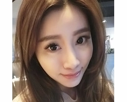 手術案例|縮人中手術+鈴鐺線拉提+玻尿酸臥蠶
