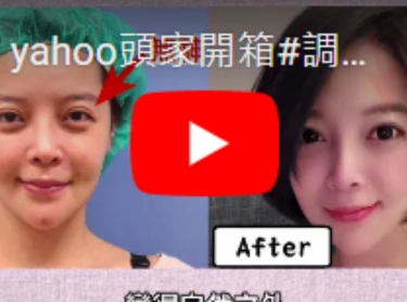 yahoo頭家開箱-小眼睛救星~朱志凱院長解析改善眼神的各種方式!