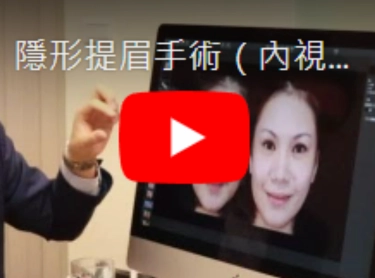 隱形提眉手術（內視鏡五爪拉提）