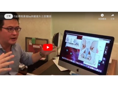 那些諮詢沒問到的事~結構式隆鼻