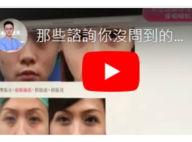 那些諮詢你沒問到的事~提眼瞼肌篇