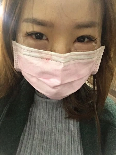 美麗見證割眼袋 美麗見證割眼袋