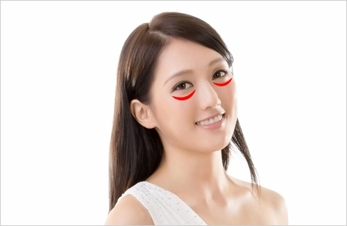 補淚溝報導