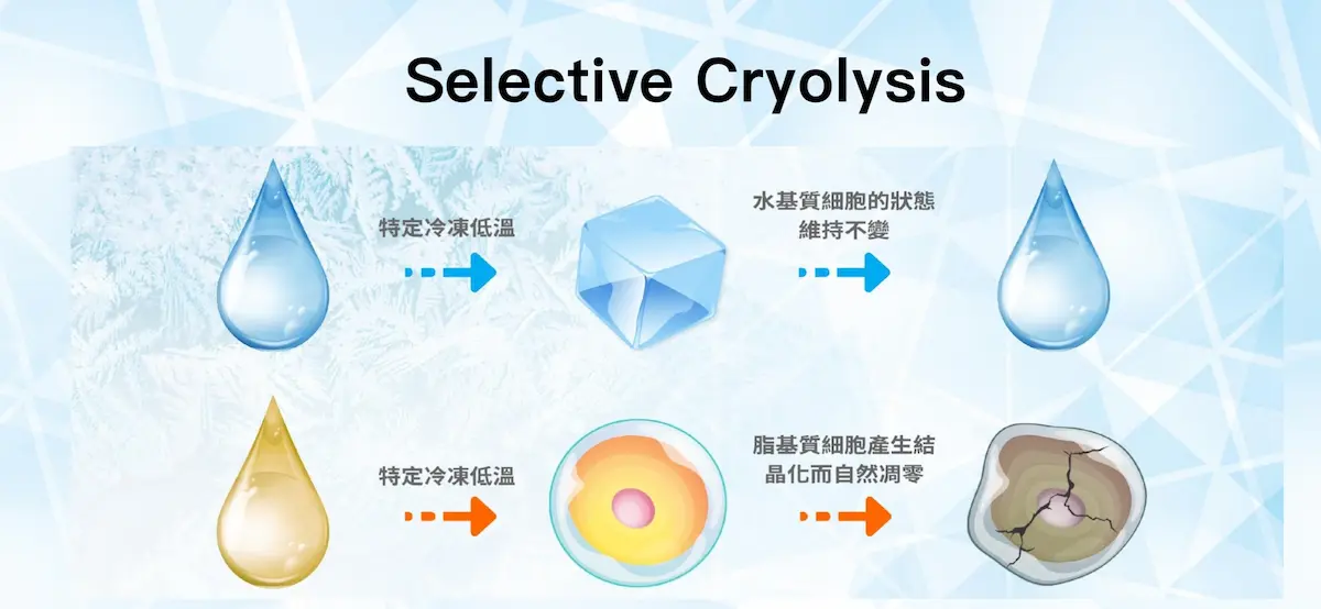 冷凍減脂 冷凍減脂