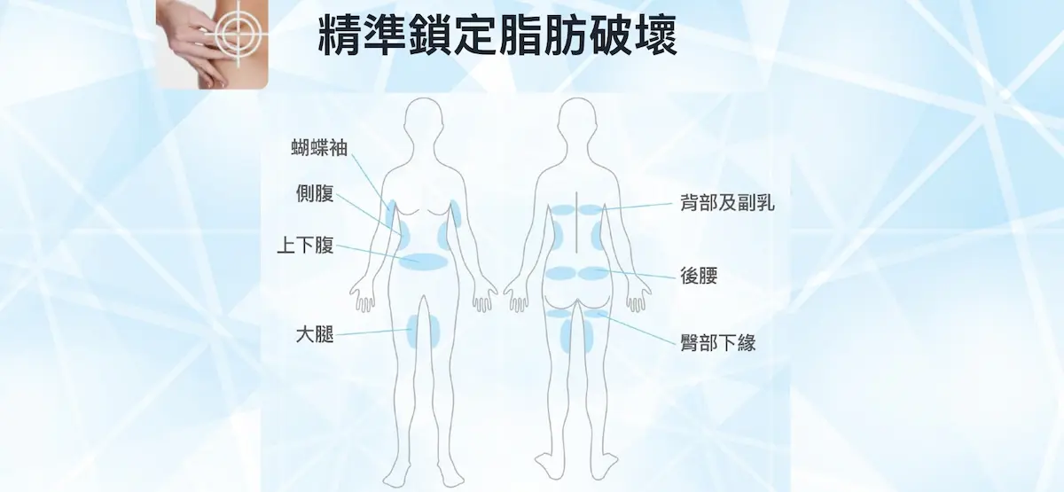 冷凍減脂 冷凍減脂