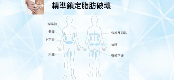 冷凍減脂 冷凍減脂