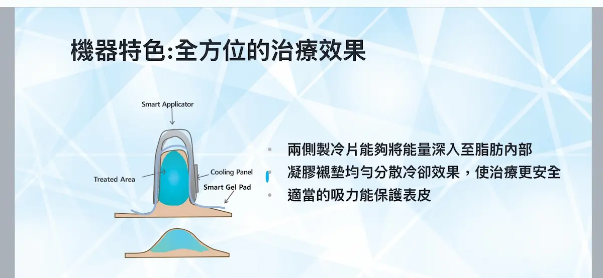 冷凍減脂 冷凍減脂 推薦開眼頭,縮鼻翼,鼻頭,微笑唇手術,眼袋