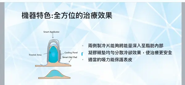 冷凍減脂 冷凍減脂