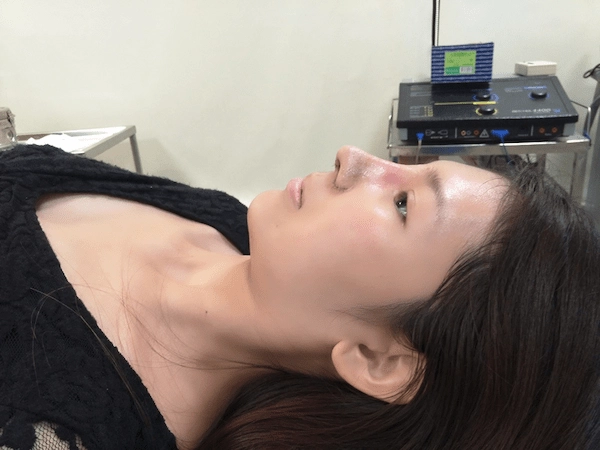 精緻鼻型見證