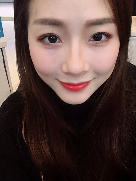 玻尿酸見證