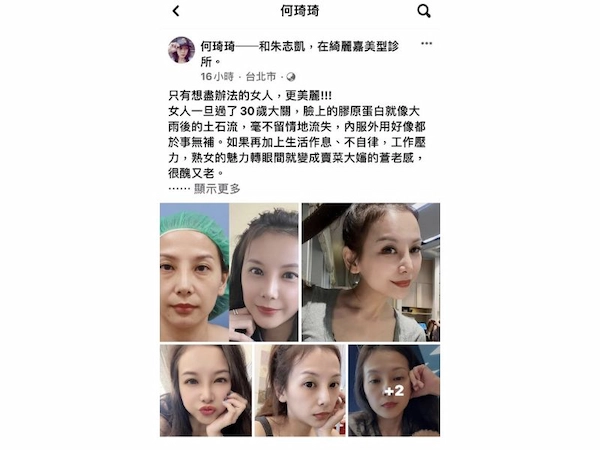 貴族手術見證
