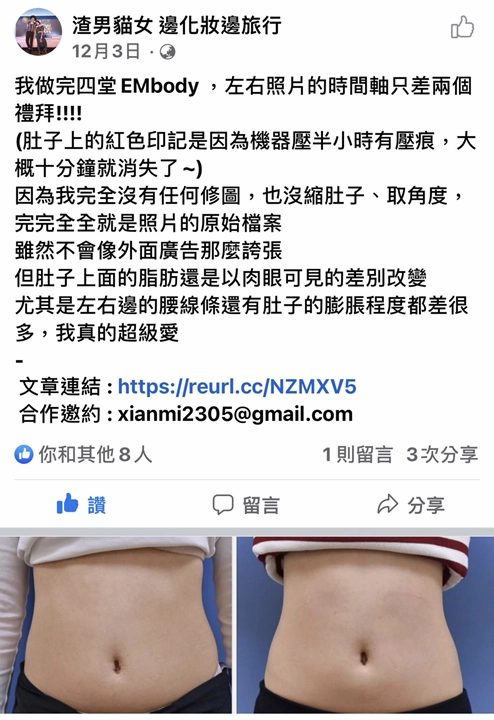 肌動腹肌見證