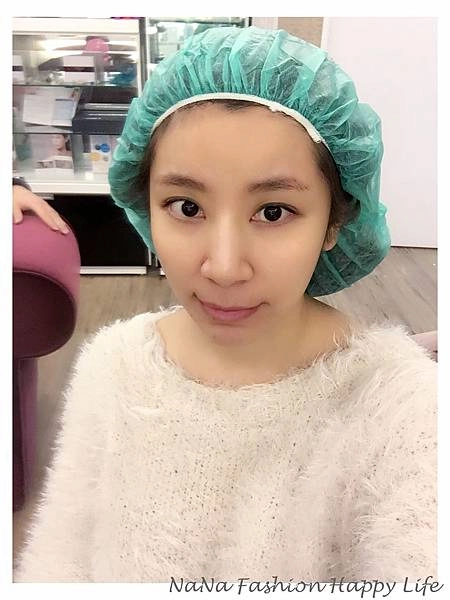縮人中手術見證