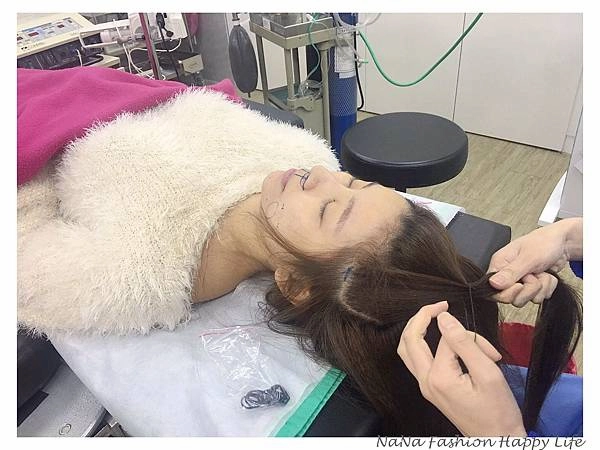 縮人中手術見證