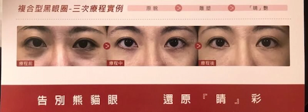 稚齡針見證