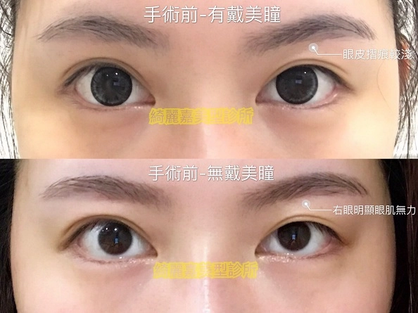 大小眼見證