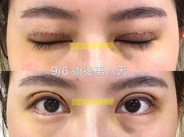 大小眼見證