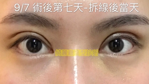 大小眼見證