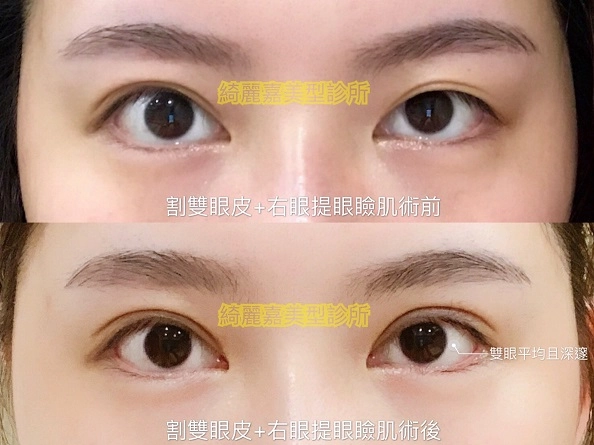 大小眼見證