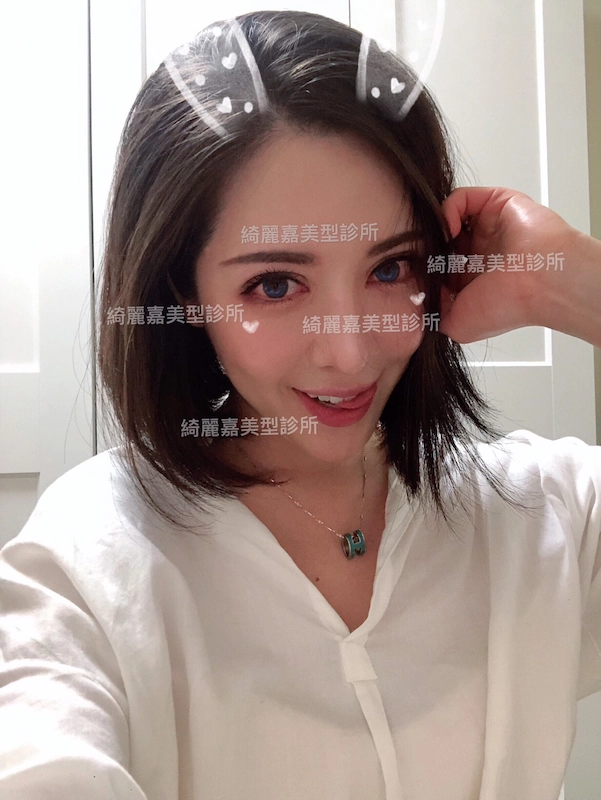 重修美眸見證