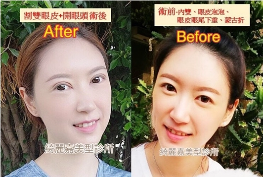 電眼進化見證