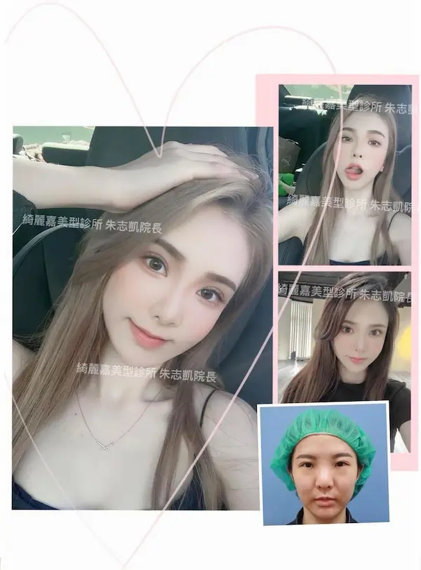 開眼尾及下置 開眼尾及下置