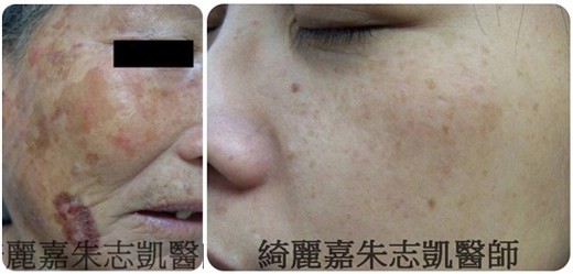 全效彩衝光 全效彩衝光