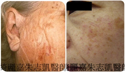 全效彩衝光 全效彩衝光