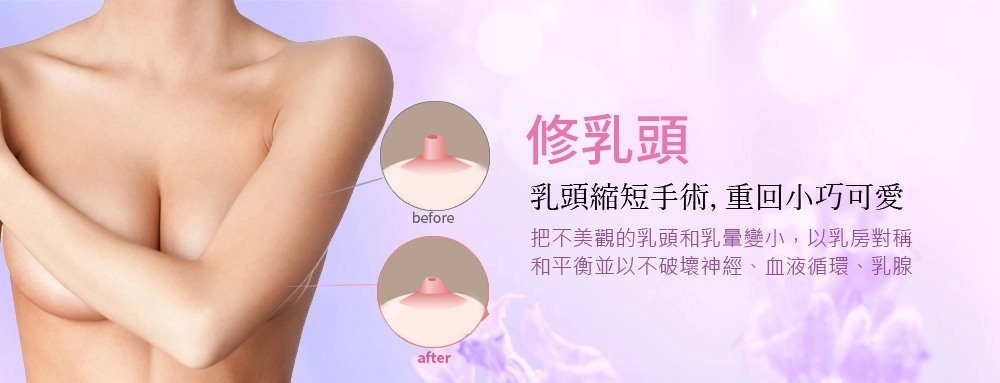 修乳頭 修乳頭