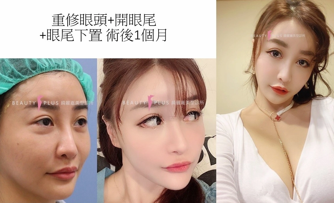 開眼尾及下置