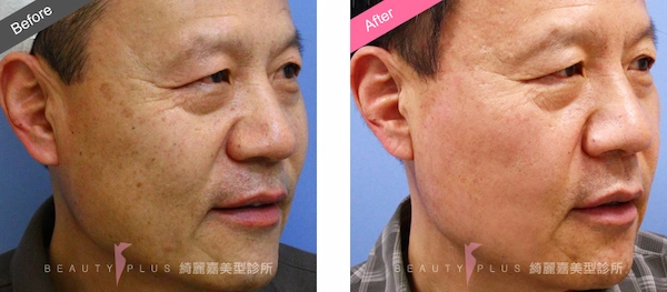 全效彩衝光 全效彩衝光