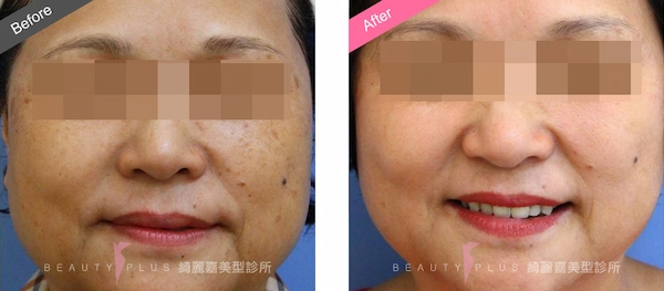 全效彩衝光 全效彩衝光
