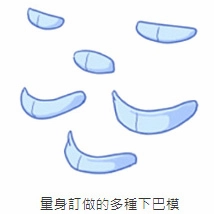內開下巴手術 內開下巴手術
