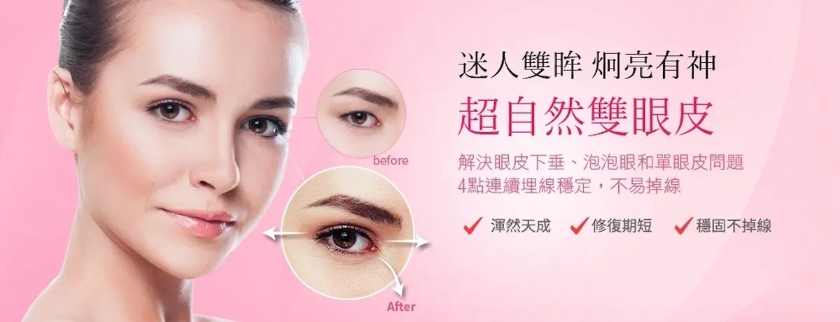 台北雙眼皮手術推薦：打造理想雙眸的關鍵