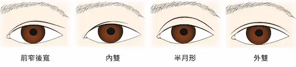 雙眼皮類別