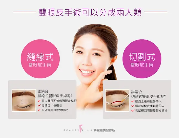 兩類雙眼皮手術