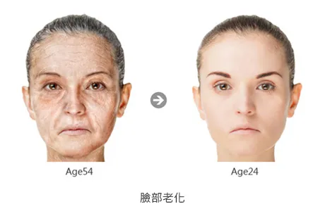 眼袋/淚溝/黑眼圈的成因有哪些