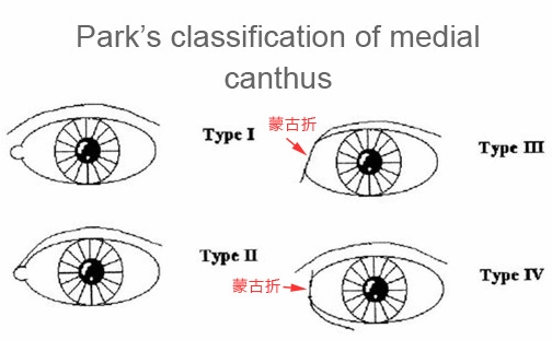眼頭的分類