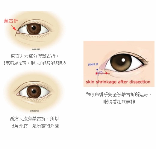 眼頭的分類2