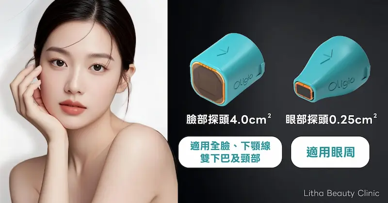 Oligio超玩美電波