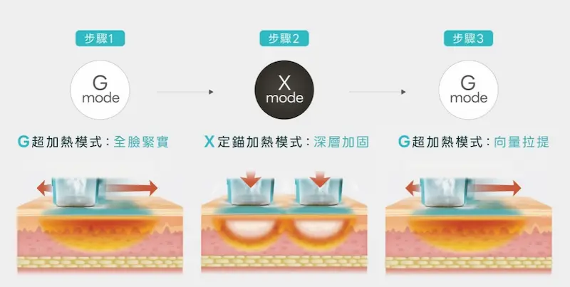 Oligio超玩美電波