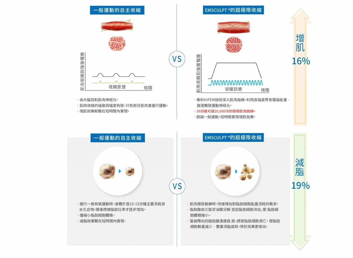 EMSCULPT® 肌動減脂 EMSCULPT® 肌動減脂