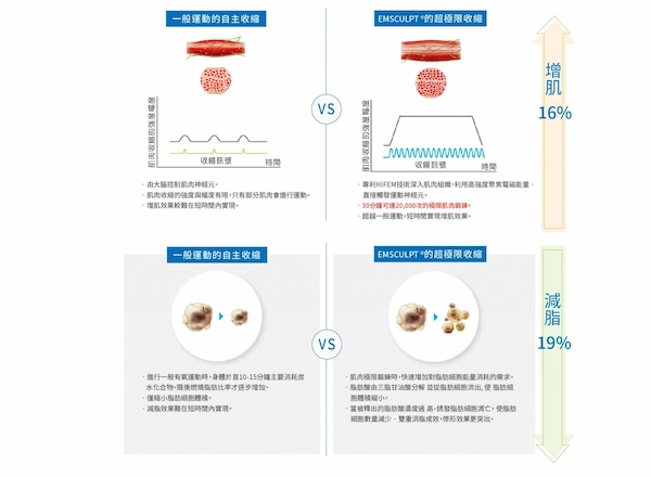 EMSCULPT® 肌動減脂 EMSCULPT® 肌動減脂
