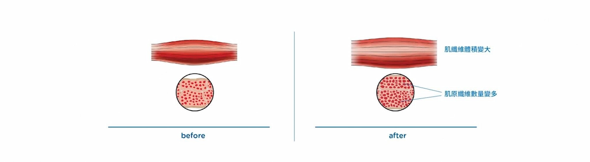 EMSCULPT® 肌動減脂 EMSCULPT® 肌動減脂