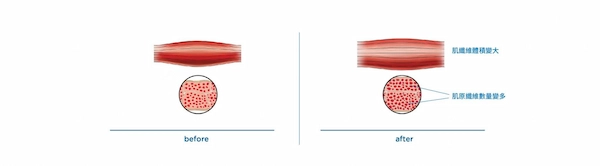 EMSCULPT® 肌動減脂 EMSCULPT® 肌動減脂